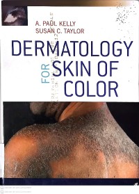 Image of Dermatology for skin of color